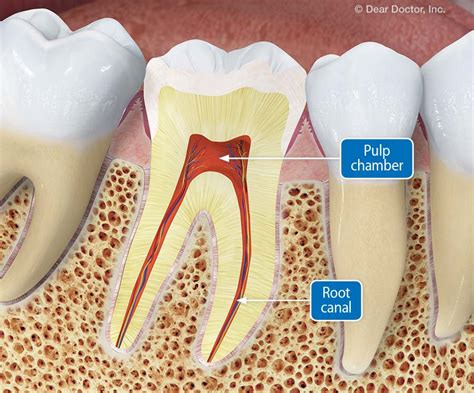 Root Canal Treatment - What You Need to Know