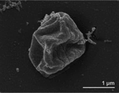 Hyperthermophilic archaeal cellular structures - microbewiki