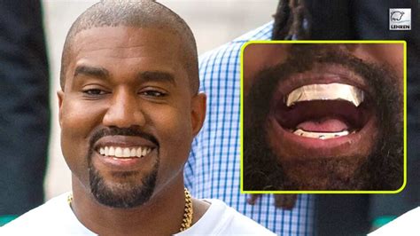 Kanye West Replaces His Teeth With Custom-Made Titanium Dentures