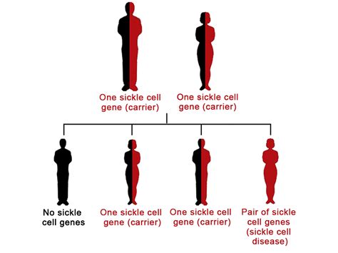 Sickle Cell Anemia In Pregnancy