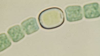 heterocyst - meddic