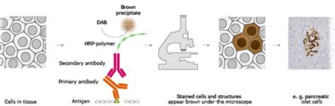 Immunohistochemistry, immunohistochemistry technique & clinical applications