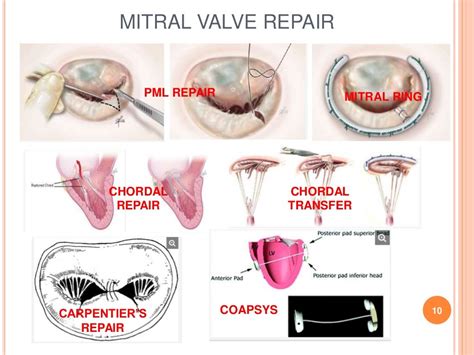 PROSTHETIC HEART VALVES