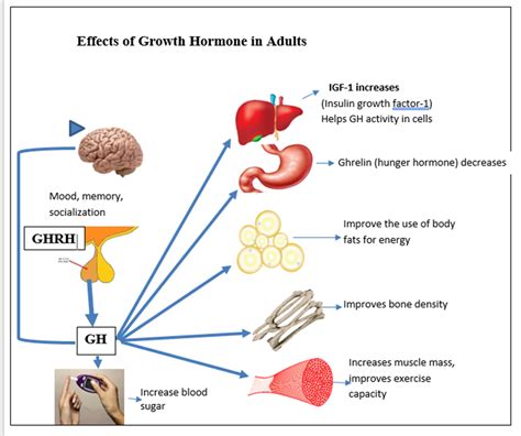 Adult Growth Hormone Deficiency - WAPO