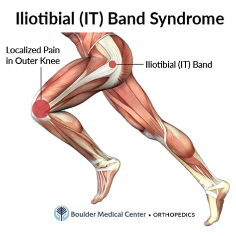 Iliotibial Band Anatomy