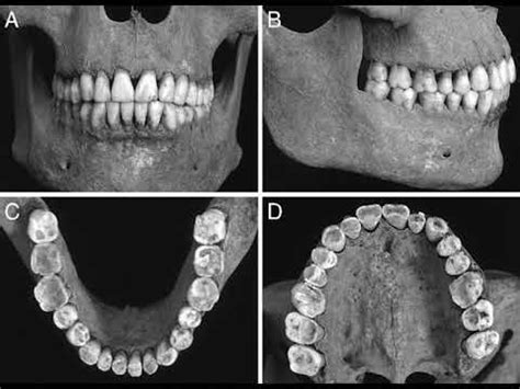 Forensic Odontology-Introduction - YouTube