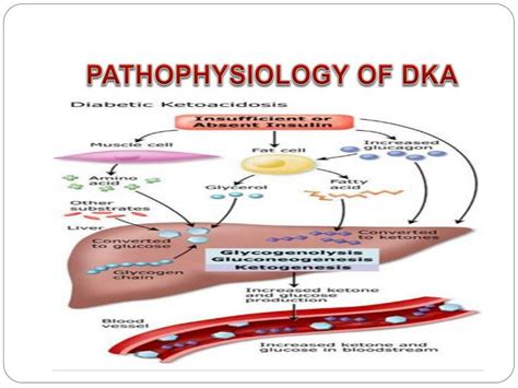 PPT - A CASE PRESENTATION OF A PATIENT WITH DIABETIC KETOACIDOCIS (DKA) PowerPoint Presentation ...