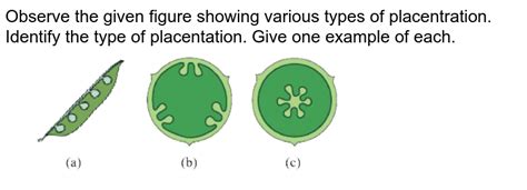 Observe the given figure showing various types of placentation. Id