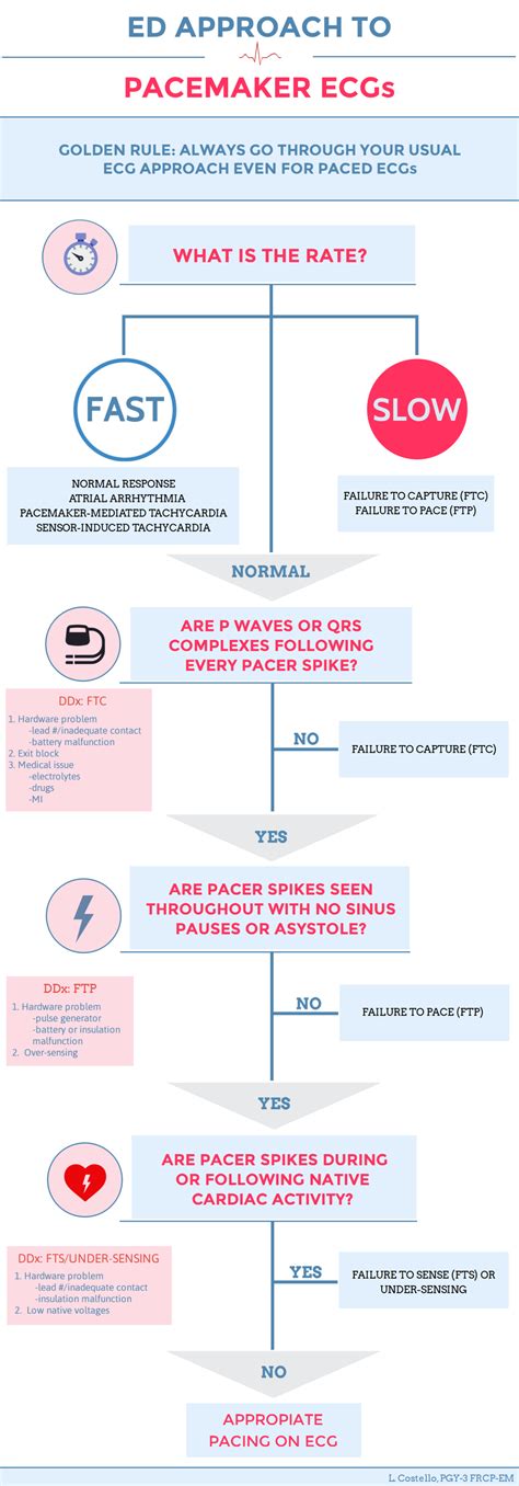 Pacemaker Essentials: How to Interpret a Pacemaker ECG - CanadiEM