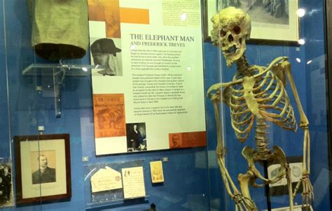 Joseph Merrick, Elephant Man, London Hospital Museum - Travel Darkly