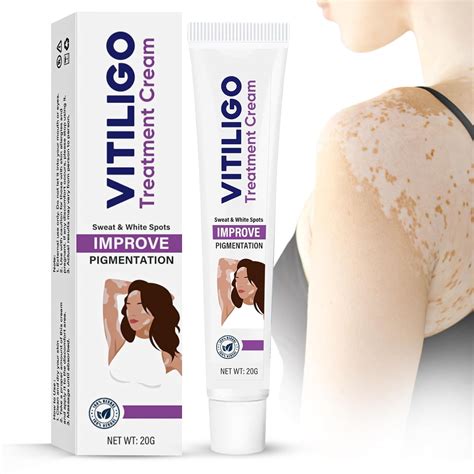 Vitiligo Cream, Vitiligo Treatment Cream for Reduce/Fade White Spot and ...