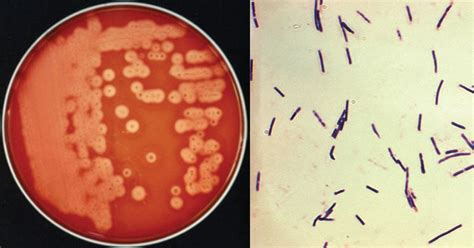 Clostridium Perfringens Gram Stain