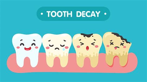 Tooth Decay: Here's How You Can Reverse It Easy Ways | OnlyMyHealth