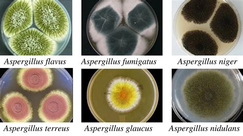 Aspergillus: Morphology, Clinical Features, and Lab Diagnosis • Microbe ...