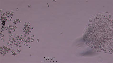 Multiple morphologies in HT29 cell line? | ResearchGate