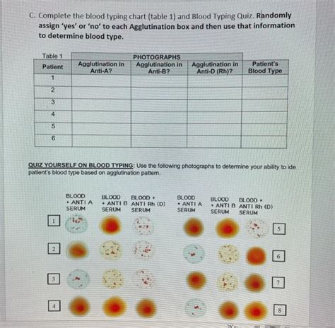 Solved C. Complete the blood typing chart (table 1) and | Chegg.com