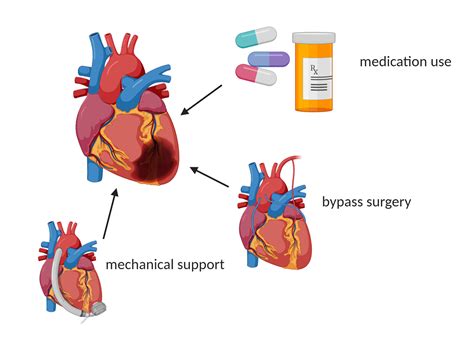 Innovative treatments for heart failure | Open Access Government