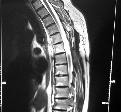 Surgical Neurology International