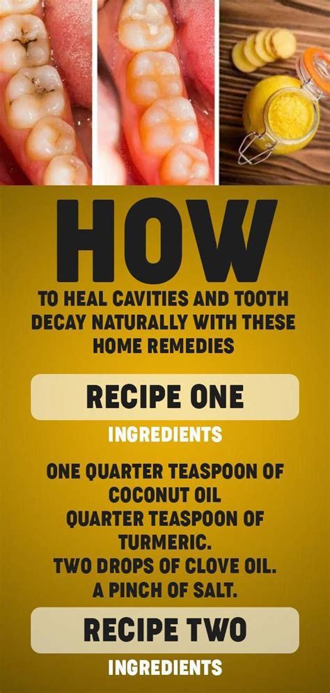 Tooth Decay Pain Home Treatment