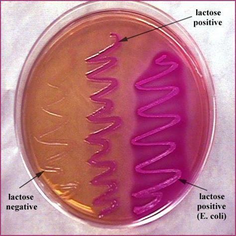 MacConkey agar - Alchetron, The Free Social Encyclopedia