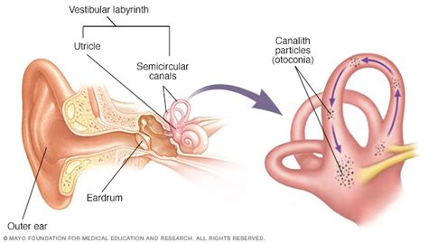 Vertigo, dizziness and the auditory system - Blog of Kiversal