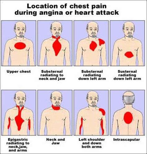 Upper chest discomfort - lokasinbets