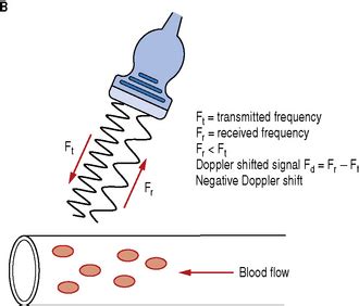 Physical principles of Doppler ultrasound | Radiology Key