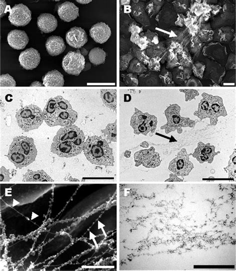 Neutrophil Extracellular Traps Kill Bacteria | Science