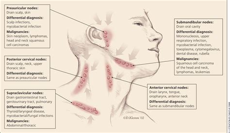 Bilateral neck lymph nodes | doctorvisit