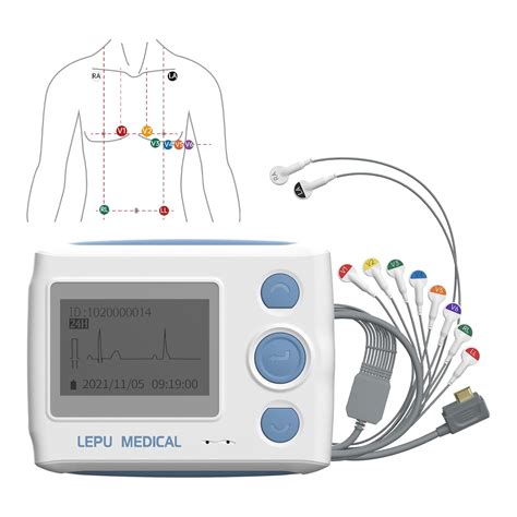 Wellue Holter ECG Monitor, Professional 12 Lead ECG Monitors, 24-Hour ECG Holter Record With AI ...