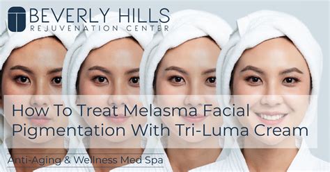 How to Treat Melasma With Tri-Luma Cream | BHRC Med Spa Blog