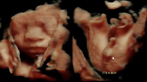 WE'RE HAVING A BABY! 5D ULTRASOUND 27WEEKS PREGNANT - YouTube