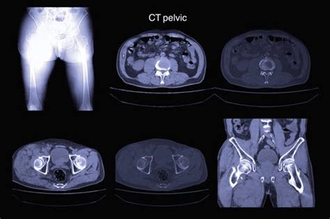 Stay on Top of In-Office CT Scan Coding Rules, Guidelines : CPT® Coding