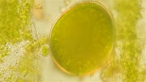 Seaweed (algae) Under Microscope, Magnification 100X Stock Footage Video 4946042 - Shutterstock