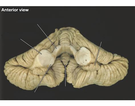 Cerebellum Anterior View — Printable Worksheet