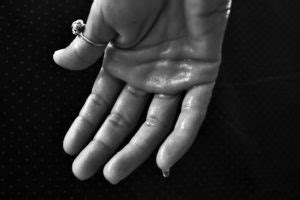 What Causes Clammy Hands? 7 Reasons & How To Stop It