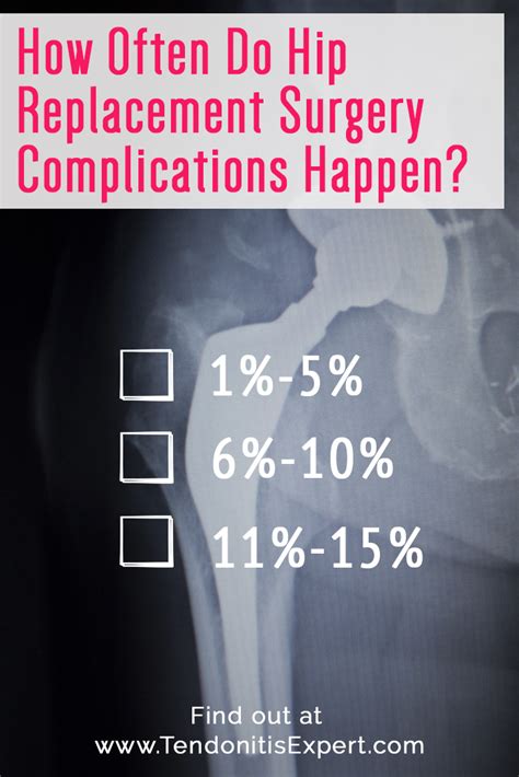 Hip Replacement Surgery, Partial And Complete, For Tendonitis?