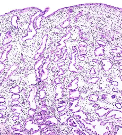 Endometrium In Secretory Phase Photograph by Jose Calvo/science Photo ...