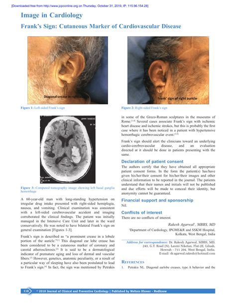 (PDF) Frank's sign: Cutaneous marker of cardiovascular disease