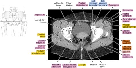 Female Pelvic Ct Scan Labeled - vrogue.co