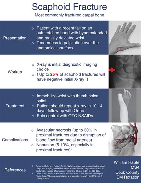 Scaphoid Fracture Avascular Necrosis