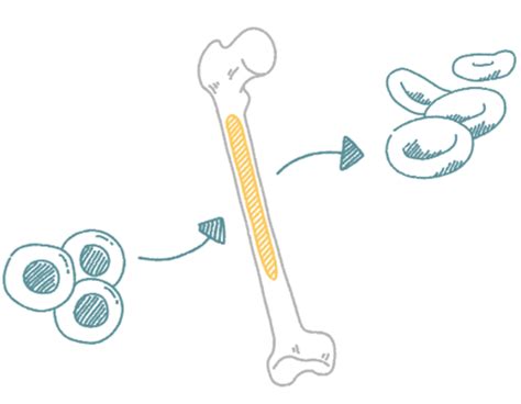 Bone Marrow Transplant | Beta Thalassemia Treatment