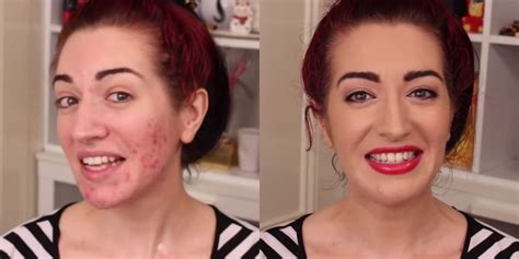 How to Cover Up Acne Scars With Makeup - Makeup Tutorial