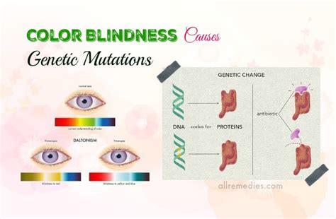 List Of 13 Common Color Blindness Causes, Symptoms, And Effects