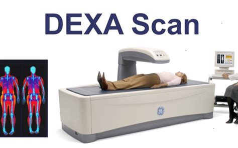 DEXA SCAN | Medicare