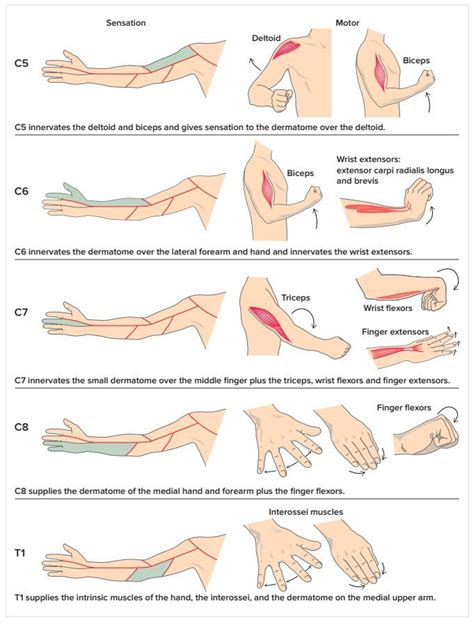 Cervical Radiculopathy | Radiculopathy, Cervical radiculopathy ...