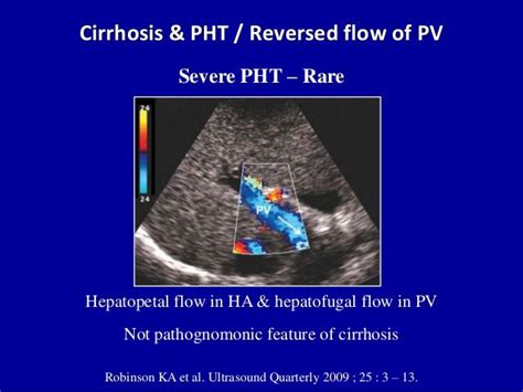 Cirrhosis & PHT / Reversed flow of PV Hepatopetal flow in HA ...