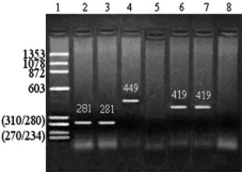 ARMS PCR using specific primers (normal and mutant) showing ...