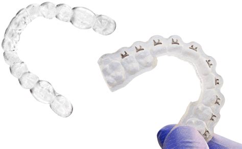 Aligners