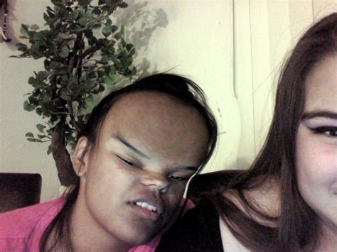 Rihanna Forehead